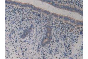 Immunohistochemistry (IHC) image for anti-GRB2-Associated Binding Protein 3 (GAB3) (AA 142-375) antibody (ABIN7443473)