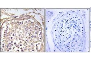 Immunohistochemistry analysis of paraffin-embedded human testis tissue, using CHST9 Antibody. (CHST9 Antikörper  (AA 361-410))