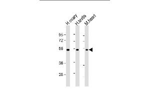 All lanes : Anti-VEGF3 Antibody at 1:2000 dilution Lane 1: human ovary lysate Lane 2: human testis lysate Lane 3: mouse heart lysate Lysates/proteins at 20 μg per lane. (VEGFC Antikörper  (C-Term, N-Term))