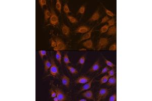 Immunofluorescence analysis of C6 cells using SEL1L antibody (ABIN6132642, ABIN6147499, ABIN6147500 and ABIN6215644) at dilution of 1:100. (SEL1L Antikörper  (AA 22-190))