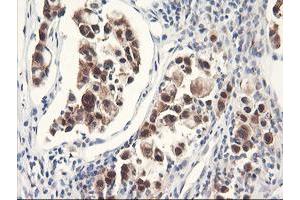 Image no. 5 for anti-F-Box Protein 21 (FBXO21) antibody (ABIN1498231) (FBXO21 Antikörper)