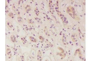 Formalin-fixed and paraffin embedded human kidney labeled with Anti-IFNAR1 Polyclonal Antibody, Unconjugated  at 1:300 followed by conjugation to the secondary antibody and DAB staining. (IFNAR1 Antikörper  (AA 351-450))