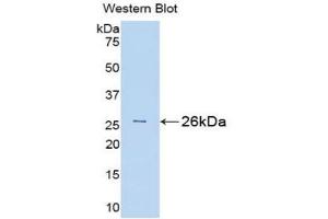 Detection of Recombinant Bid, Rat using Polyclonal Antibody to BH3 Interacting Domain Death Agonist (Bid) (BID Antikörper  (AA 1-196))