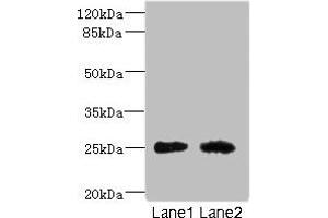 Western blot All lanes: CEACAM4 antibody at 1. (CEACAM4 Antikörper  (AA 36-155))