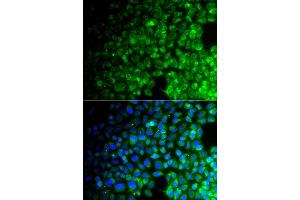 Immunofluorescence analysis of A549 cell using USP10 antibody.