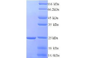 SDS-PAGE (SDS) image for Hematological and Neurological Expressed 1 (HN1) (AA 2-154) protein (His tag) (ABIN5714508) (HN1 Protein (AA 2-154) (His tag))