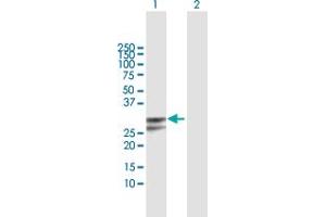 Western Blot analysis of PPP1R2P3 expression in transfected 293T cell line by PPP1R2P3 MaxPab polyclonal antibody. (PPP1R2P3 Antikörper  (AA 1-205))