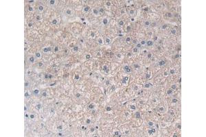 Immunohistochemistry (IHC) image for anti-Prostaglandin F2 Receptor Negative Regulator (PTGFRN) (AA 406-662) antibody (ABIN7444352)