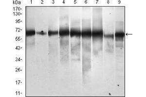 Western blot analysis using SQSTM1 mouse mAb against Hela (1), Jurkat (2), THP-1 (3), HEK293 (4), A549 (5), MCF-7 (6), HepG2 (7), COS7 (8) and SK-BR-3 (9) cell lysate. (SQSTM1 Antikörper  (AA 232-356))