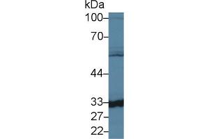 Detection of CA5B in Mouse Liver lysate using Polyclonal Antibody to Carbonic Anhydrase VB, Mitochondrial (CA5B) (CA5B Antikörper  (AA 63-225))