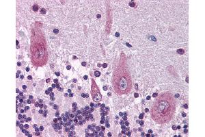 Anti-KIF21A antibody IHC of human brain, cerebellum. (KIF21A Antikörper  (AA 551-600))