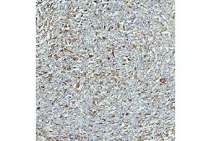 IHC analysis of ALDH1A1 using anti-ALDH1A1 antibody (ABIN7602128).