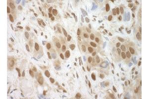 Immunohistochemistry (IHC) image for anti-BRCA1/BRCA2-Containing Complex, Subunit 3 (BRCC3) (AA 266-316) antibody (ABIN7448440)