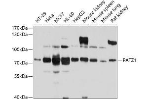 Western blot analysis of extracts of various cell lines, using P antibody (ABIN6132856, ABIN6145252, ABIN6145253 and ABIN6214168) at 1:1000 dilution. (PATZ1 Antikörper  (AA 250-350))