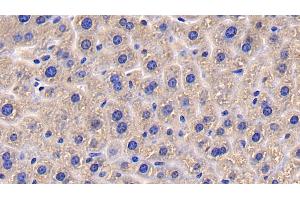 Immunohistochemistry (IHC) image for anti-Dipeptidyl-Peptidase 4 (DPP4) (AA 29-178) antibody (ABIN7432832)