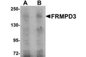 Western blot analysis of FRMPD3 in Jurkat cell lysate with AP30348PU-N FRMPD3 antibody at (A) 1 and (B) 2 μg/ml. (FRMPD3 Antikörper  (Center))