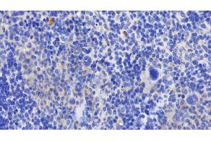 Detection of GPX1 in Mouse Spleen Tissue using Polyclonal Antibody to Glutathione Peroxidase 1 (GPX1) (Glutathione Peroxidase 1 Antikörper  (AA 48-201))