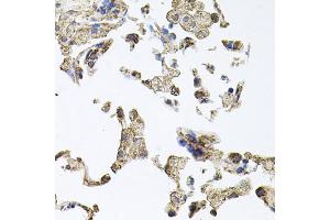 Immunohistochemistry of paraffin-embedded human lung using PKN1 antibody. (PKN1 Antikörper)
