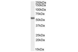 Image no. 2 for anti-Forkhead Box C1 (FOXC1) (C-Term) antibody (ABIN374336) (FOXC1 Antikörper  (C-Term))