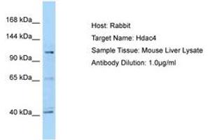 Image no. 1 for anti-Histone Deacetylase 4 (HDAC4) (C-Term) antibody (ABIN6749909) (HDAC4 Antikörper  (C-Term))