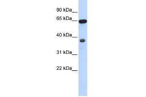 WB Suggested Anti-RCC2 Antibody Titration: 0.
