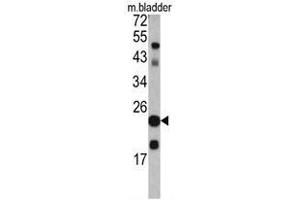 Western blot analysis of TAGLN antibody (C-term) in mouse bladder tissue lysates (35ug/lane). (Transgelin Antikörper  (C-Term))