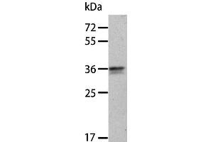 Western Blot analysis of A549 cell using ANXA8 Polyclonal Antibody at dilution of 1:300 (Annexin VIII Antikörper)