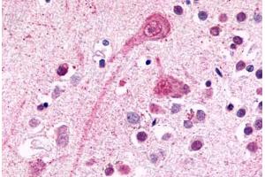 Anti-BDKRB2 / BK-2 antibody  ABIN1048349 IHC staining of human brain, neurons and glia. (BDKRB2 Antikörper  (C-Term))