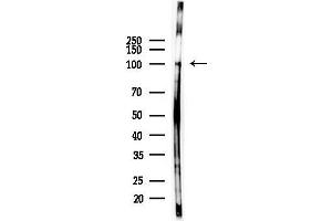 Western blot analysis of lysates from COLO205 cells(heat-shock,45 min treatment), using Phospho-FGFR1 (Tyr154) Antibody at 1/1000 dilution.