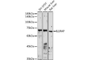 Western blot analysis of extracts of various cell lines, using IL1RAP antibody (ABIN6128127, ABIN6142347, ABIN6142348 and ABIN6220984) at 1:1000 dilution.