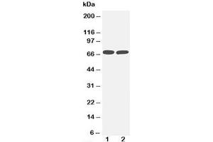 Western blot testing of TNFR2 antibody and Lane 1:  MM453;  2: Jurkat cell lysate. (TNFRSF1B Antikörper  (Middle Region))