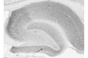 Adult rat brain hippocampus immunohistochemistry. (DLG2 Antikörper  (AA 1-852))