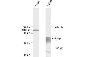 dilution: 1 : 1000, sample: left: rat brain homogenate; right: retina extract (Ribeye (AA 974-988) Antikörper)