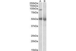 Western Blotting (WB) image for anti-Ubiquitin Specific Peptidase 6 (USP6) (C-Term) antibody (ABIN2466427) (USP6 Antikörper  (C-Term))