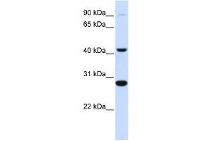 CYB561 antibody used at 1 ug/ml to detect target protein.