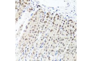 Immunohistochemistry of paraffin-embedded mouse stomach using PARP1 antibody at dilution of 1:100 (x40 lens). (PARP1 Antikörper)