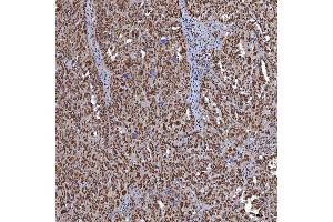 IHC analysis of TRMT61A using anti-TRMT61A antibody (ABIN7599220).