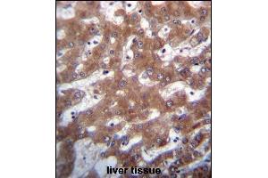 TRUB1 Antibody (Center) (ABIN656716 and ABIN2845945) immunohistochemistry analysis in formalin fixed and paraffin embedded human liver tissue followed by peroxidase conjugation of the secondary antibody and DAB staining. (TRUB1 Antikörper  (AA 152-180))