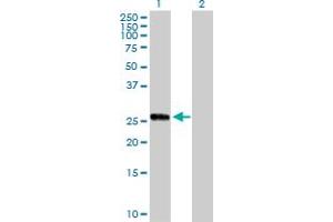 Western Blot analysis of CCRK expression in transfected 293T cell line by CCRK MaxPab polyclonal antibody. (CCRK Antikörper  (AA 1-275))