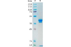 SDS-PAGE (SDS) image for Mucin 1 (MUC1) (AA 1036-1156) protein (Fc Tag) (ABIN7092712)