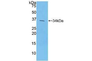 Western blot analysis of recombinant Mouse IRF4. (IRF4 Antikörper  (AA 175-433))