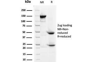 SDS-PAGE Analysis Purified Prohibitin Mouse Monoclonal Antibody (SPM311). (Prohibitin Antikörper  (AA 167-261))