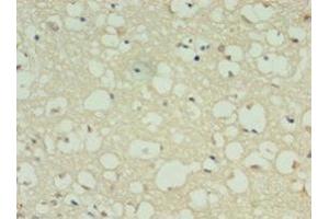 Immunohistochemistry of paraffin-embedded human brain tissue using ABIN7149470 at dilution of 1:100 (DRD5 Antikörper  (AA 361-477))