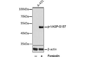 Western blot analysis of extracts of  cells, using Phospho-VASP-S157 antibody (ABIN6135335, ABIN6136286, ABIN6136287 and ABIN6225657) at 1:2000 dilution. (VASP Antikörper  (pSer157))