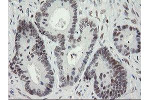 Image no. 2 for anti-Transducin-Like Enhancer of Split 1 (E(sp1) Homolog, Drosophila) (TLE1) (AA 180-460) antibody (ABIN1491050)