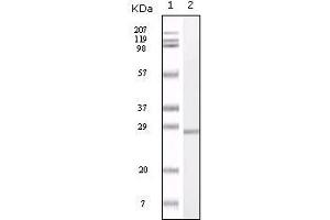 Western blot analysis using S100A mouse mAb against truncated S100A recombinant protein. (S100A1 Antikörper)