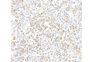 Immunohistochemistry (IHC) image for anti-CD96 (CD96) (AA 29-502) antibody (ABIN7455093) (Rekombinanter CD96 Antikörper  (AA 29-502))