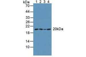 Figure. (ARPC4 Antikörper  (AA 3-165))