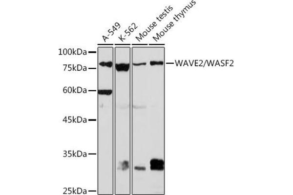 WASF2 抗体