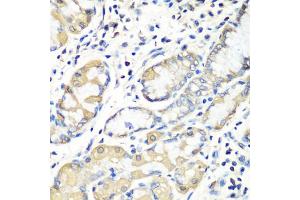 Immunohistochemistry of paraffin-embedded human stomach using EZR antibody. (Ezrin Antikörper)